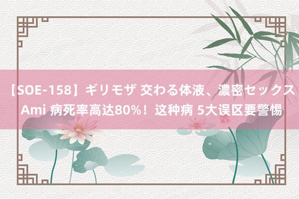 【SOE-158】ギリモザ 交わる体液、濃密セックス Ami 病死率高达80%！这种病 5大误区要警惕